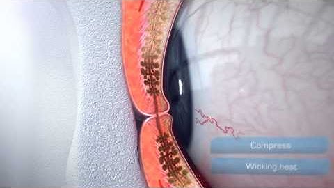 Warm Compress Therapy