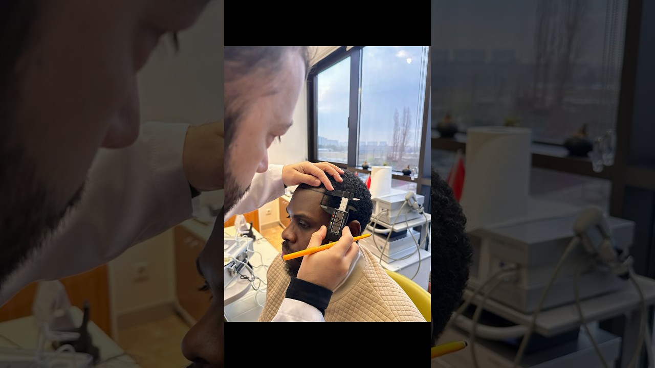 Hair Transplant Turkey