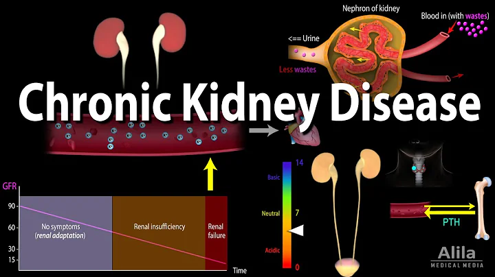 Chronic Kidney Disease, Animation - DayDayNews