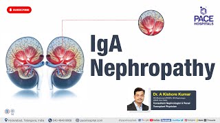 IgA Nephropathy  Reason, Symptoms, Diagnosis & Treatments | Glomerular Disease | CKD