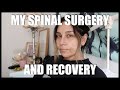 MY SPINAL SURGERY & RECOVERY ✨ THE JO DEDES AESTHETIC