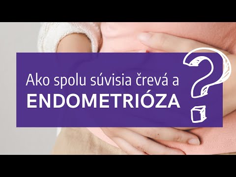 Video: 3 spôsoby, ako rozpoznať príznaky endometriózy