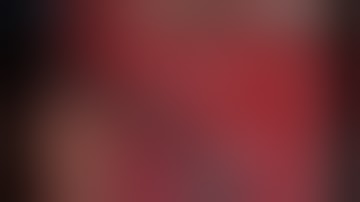 Lab Demo: Splitting of Sylvian Fissure - Yashar Kalani, MD , PhD