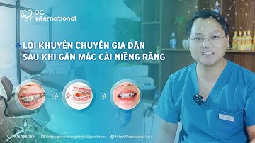 Lời Chuyên Gia Dặn Sau Khi Gắn Mắc Cài Niềng Răng! Dr Cường