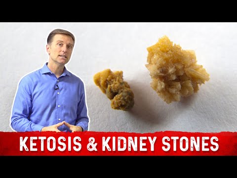 Ketosis & Kidney Stone Prevention