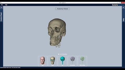 tDCS in bulimic patients modeled in HD-Explore.