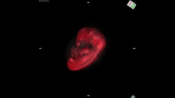 CS17 human embryo (3D reconstructed whole body)