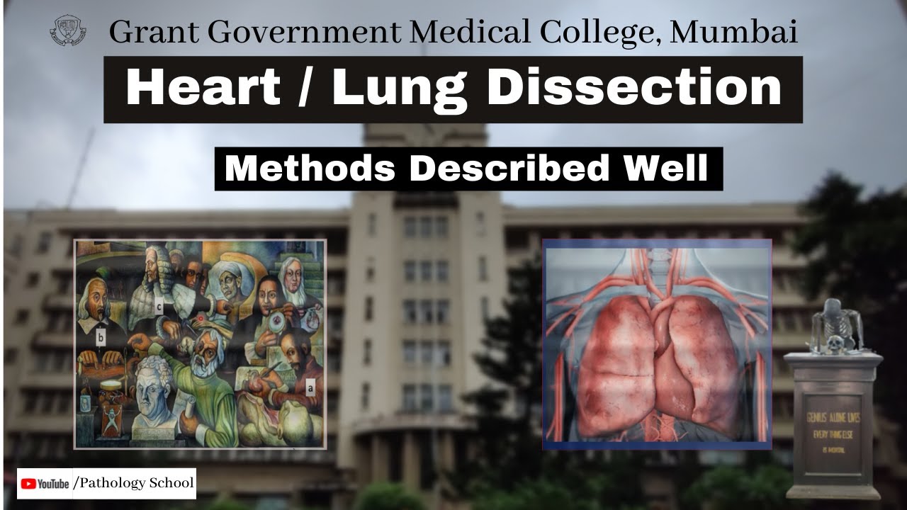 Heart Lung Dissection in Autopsy by Dr Richa - YouTube