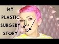 My Plastic Surgery Story