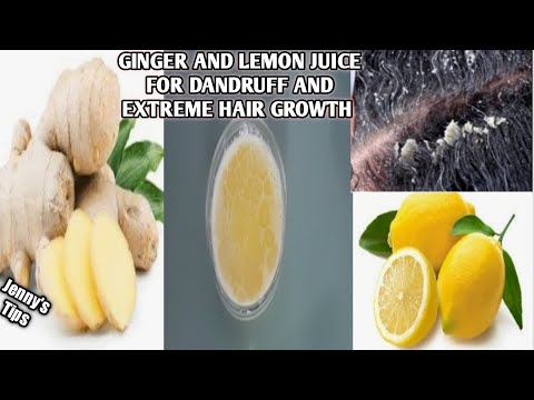 HOW TO DIY LEMON AND GINGER JUICE FOR DANDRUFF |SCALP INFECTIONS AND EXTREME HAIR GROWTH