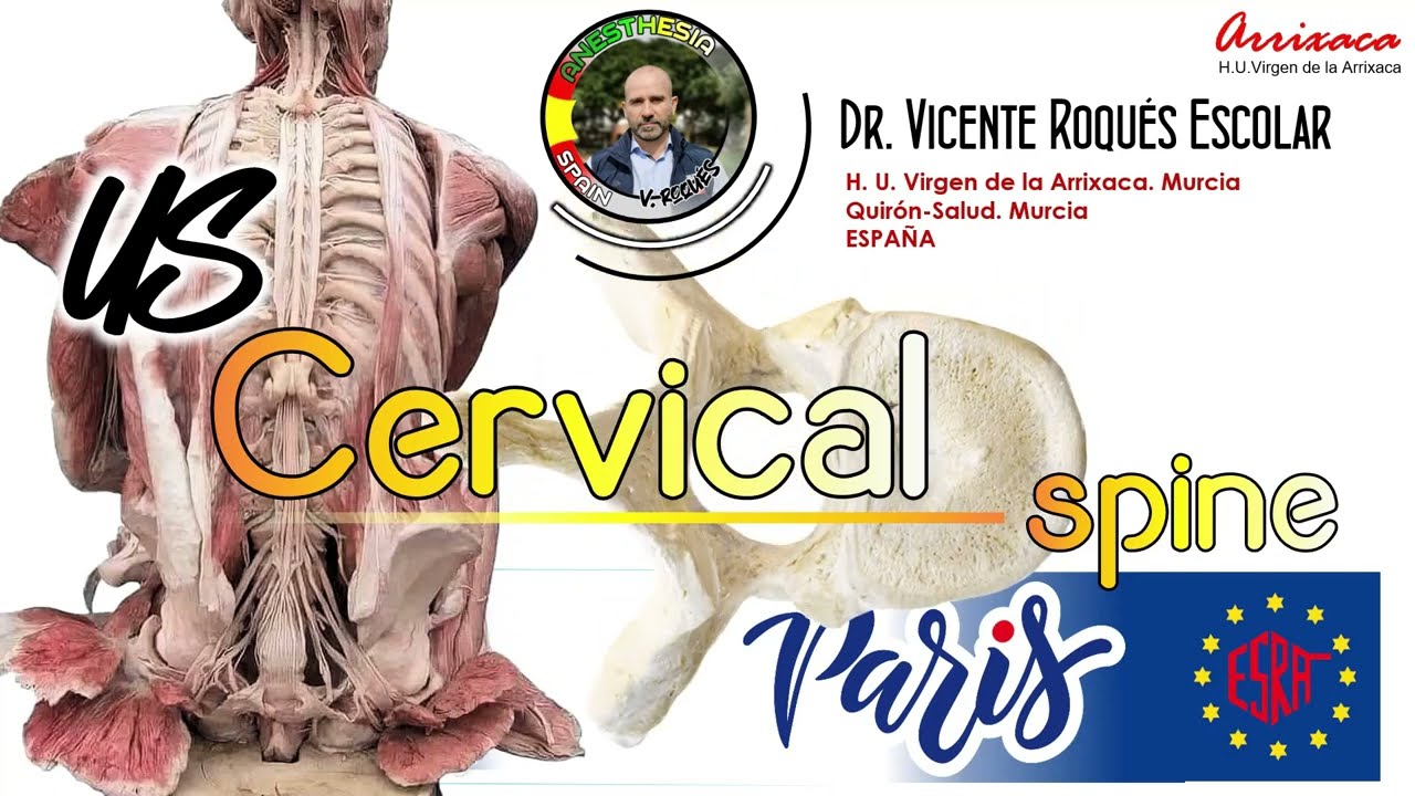 CERVICAL FACET JOINT AND MEDIAL BRANCH INJECTION (WORKSHOP WCRA PARIS 2023)