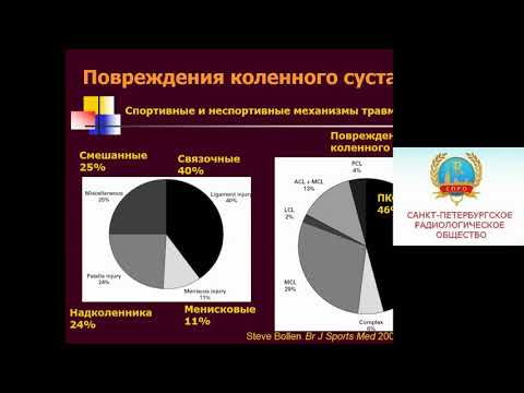 Карпенко А.К.«МРТ передней крестообразной связки: до и после операции»