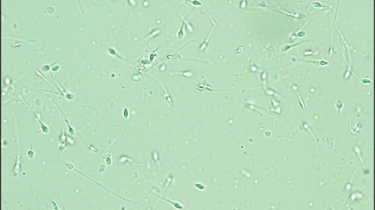 Sperm Motility Assessment Exercise 2 YouTube