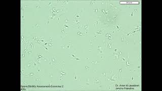 Sperm Motility Assessment exercise 2