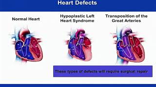 Major Birth Defects - Quick review Profile