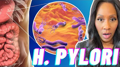 H. PYLORI: WHAT IS H. PYLORI? What Are SYMPTOMS? What CAUSES IT? What Are the TREATMENTS?