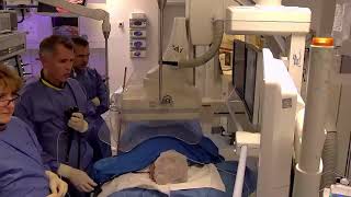 1 Ercp With Papillectomy By Dr Torsten Beyna