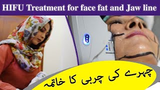 HIFO Treatment for Face Fat Reduction by Dr. Umme Raheel