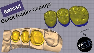Exocad Quick Guide: Copings