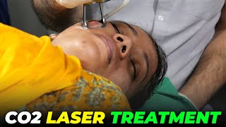 Transform Your Skin with Fractional Co2 Laser | Awish Clinic | #viral #smoothskin