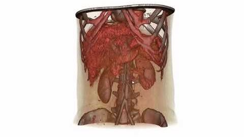 Anatomical Volume Deformation