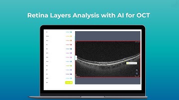 AI for Retina Layers Analysis on OCT