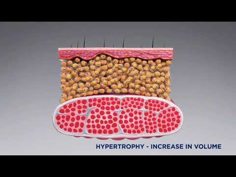 HIEMT Machine Treatment Principle Video