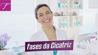 Leva para iv quanto fluidos após as cicatrizarem tempo veias