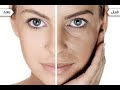 طريقه عمل ماسك جديد للوجه لتبيض الوجه ام اوشه