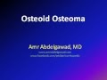 osteoid osteoma
