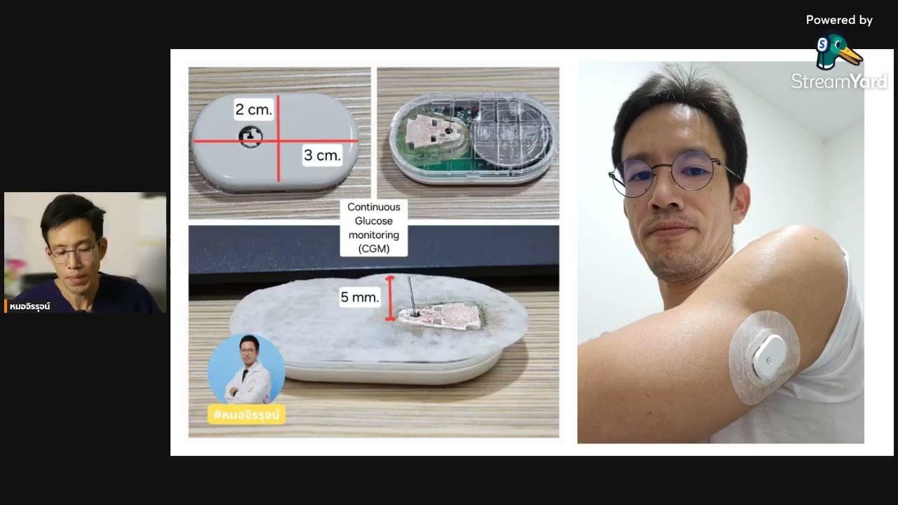 ผลของการเพิ่มขึ้นของระดับน้ำตาลอย่างรวดเร็ว (Blood sugar spike)