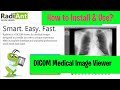 DICOM Images: How to download, install and use RadiAnt Viewer l ITFO