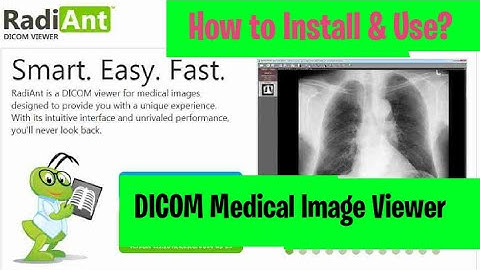 DICOM Images: How to download, install and use RadiAnt Viewer l ITFO