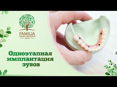 🦷 Одноэтапная имплантация