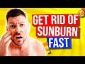 How To Get Rid of Sunburn Fast in 2024