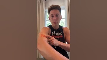 Super Patch x Connor Printz