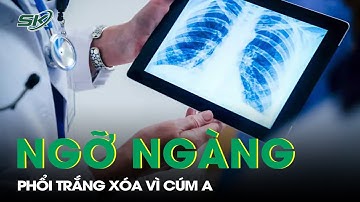 Ngỡ Ngàng Phổi Trắng Xóa Vì Mắc Cúm A | SKĐS