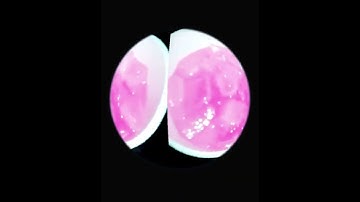 Slurr Wok (Snippet)👀