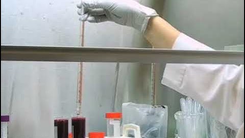 MHC Class II Tetramer-Based Antigen-Specific CD4+ T Cell Visualization