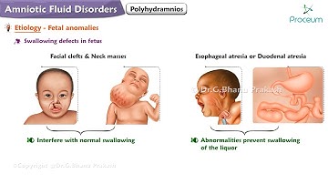 Amniotic Fluid Disorders: Polyhydramnios