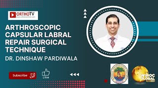 Arthroscopic Capsular Labral Repair surgical Technique - Dr. Dinshaw Pardiwala screenshot 1