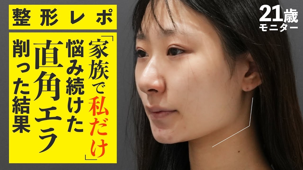 Plastic Surgery Report] 