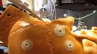 Image-guided robot for skull base surgery
