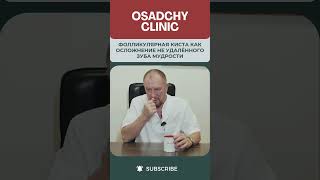 Фолликулярная киста как осложнение не удалённого зуба мудрости #докторосадчий #стоматологиякиев