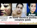 Chemical peeling in Malayalam. Acid peeling. Salicylic peel, Glycolic peel, Lactic peel, TCA peel.
