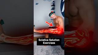 3-Step Sciatica Fix!