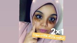 علاج الهالات بطريقة طبيعيه| DIY