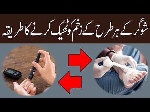 Sugar K Zakham Ka Ilaj Kamyab Noskha 100% Desi Ilaj In Urdu |' Hindi ' Sehat Hai Zindagi