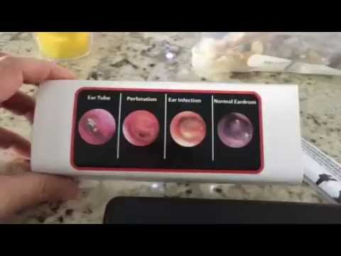 HARD CASE Doctor Mom Original Pocket Otoscope Review