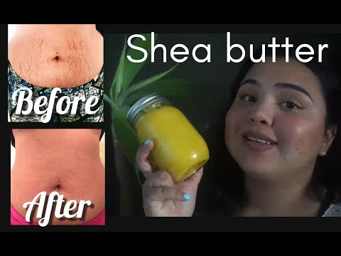 Video: Shea Butter Prevents The Appearance Of Stretch Marks